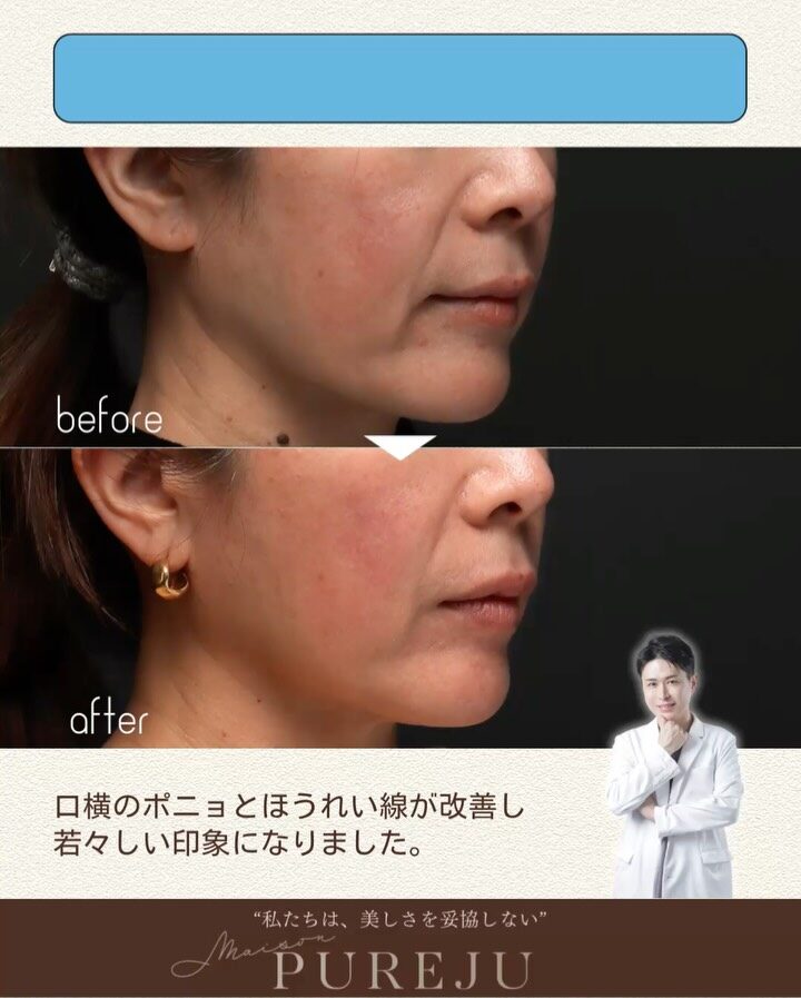 Instagram post from maison_pureju. This post is in position 3.