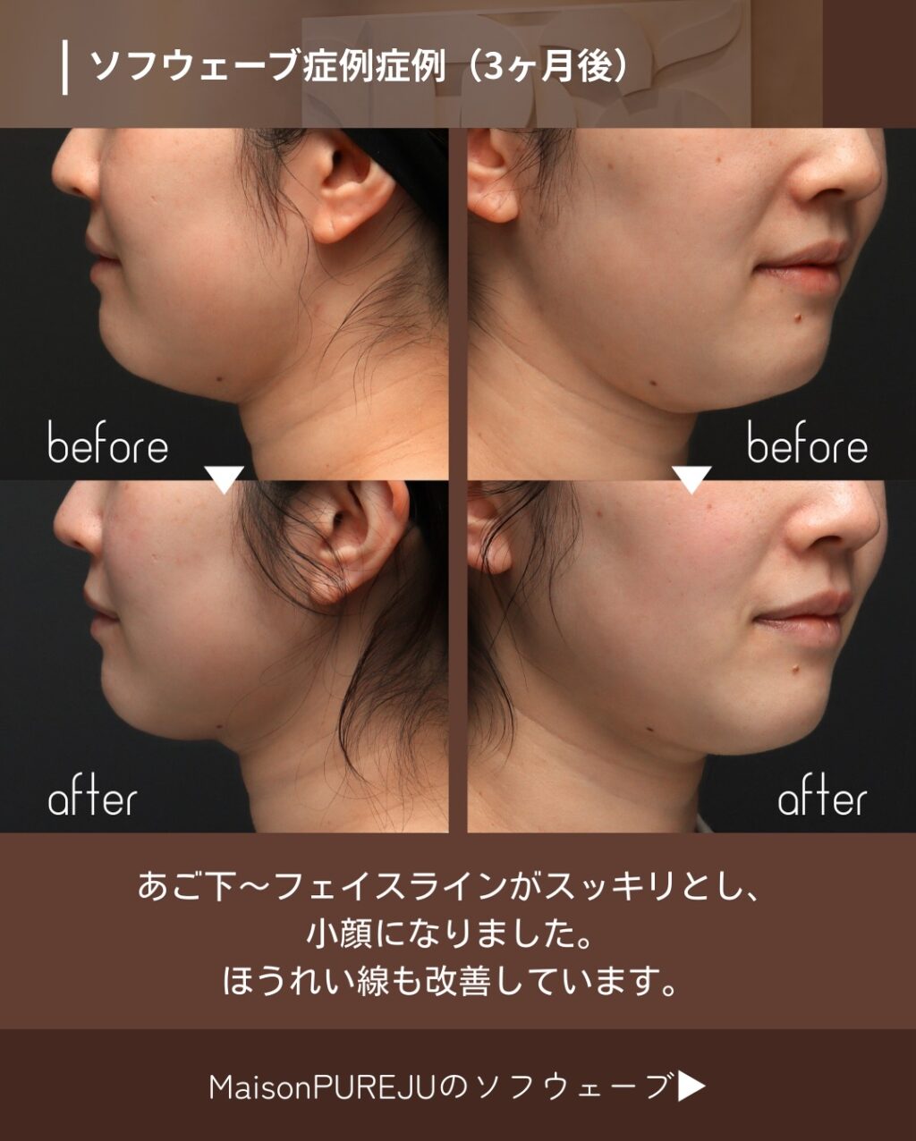 Instagram post from maison_pureju. This post is in position 2.