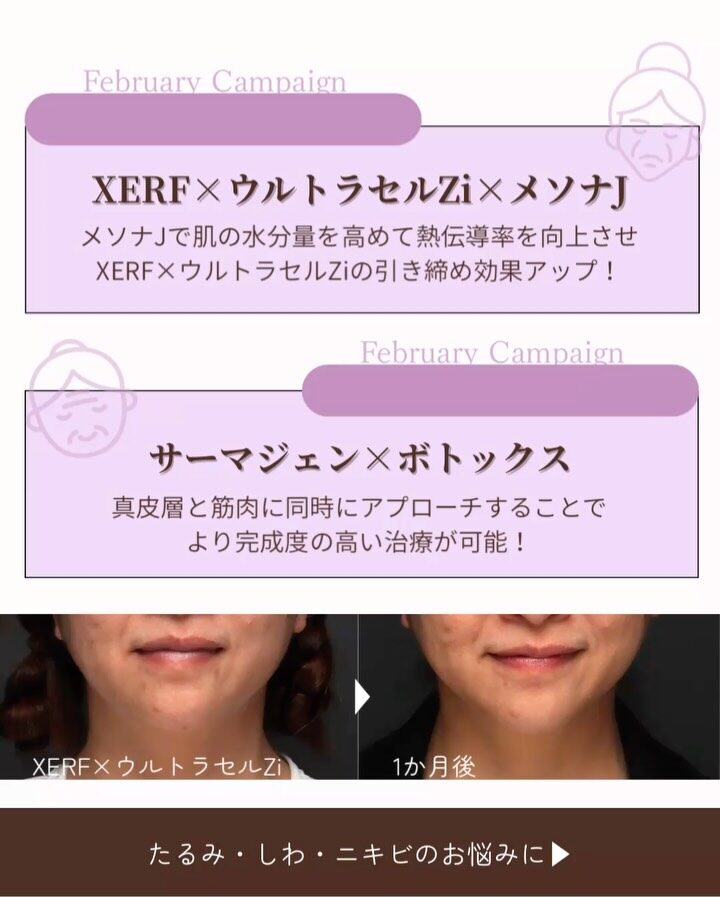 Instagram post from maison_pureju. This post is in position 1.