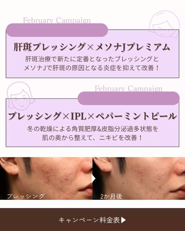 Instagram post from maison_pureju. This post is in position 2.