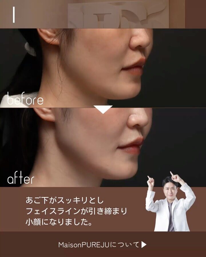 Instagram post from maison_pureju. This post is in position 2.