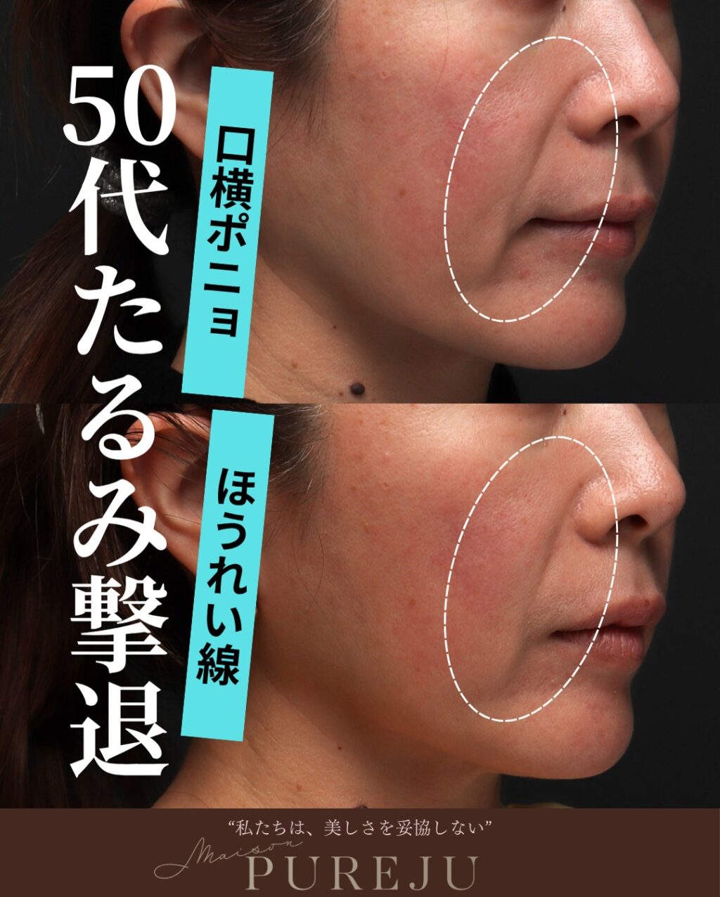 Instagram post from maison_pureju. This post is in position 1.