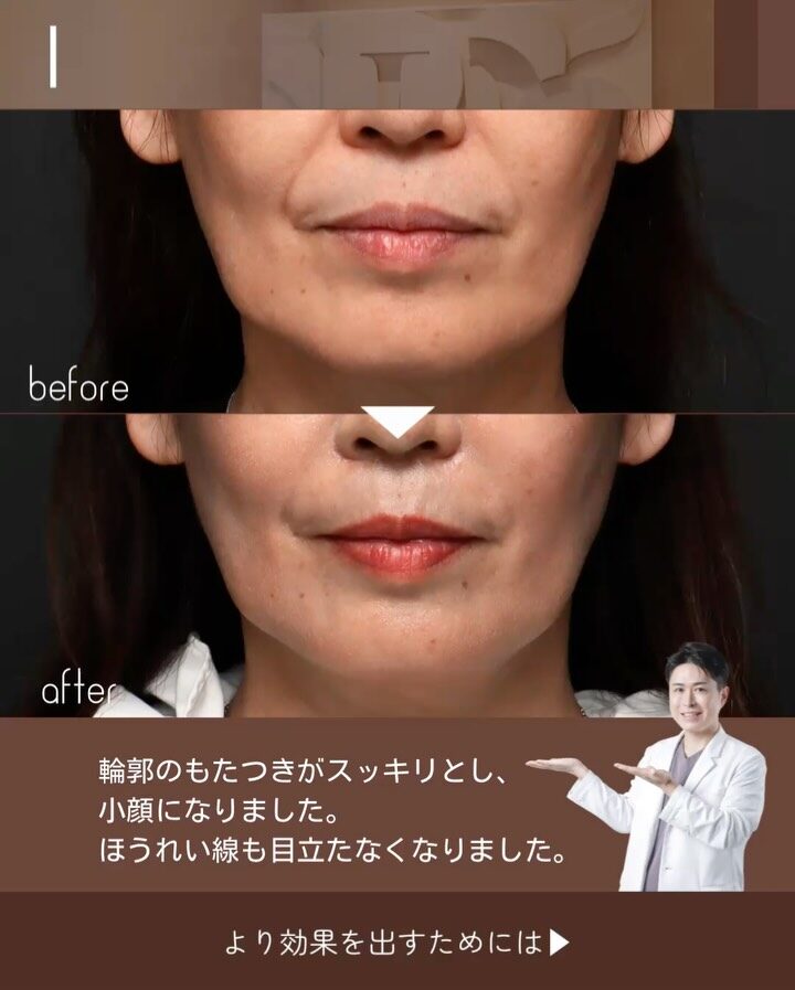 Instagram post from maison_pureju. This post is in position 2.